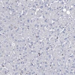 LRCH4 Antibody, Novus Biologicals 25 &mu;L; Unconjugated:Antibodies, Polyclonal