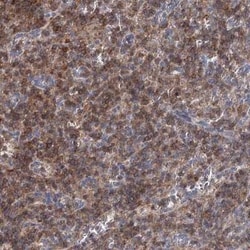 LRCH4 Antibody, Novus Biologicals 25 &mu;L; Unconjugated:Antibodies, Polyclonal