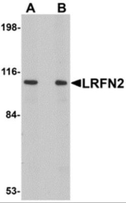 LRFN2 Antibody - BSA Free, Novus Biologicals 0.1 mg | Buy Online | Novus Biologicals | Fisher Scientific