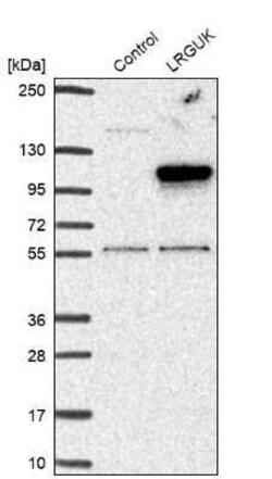 LRGUK Antibody, Novus Biologicals 25 &mu;L | Buy Online | Novus Biologicals | Fisher Scientific