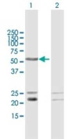 LRIF1 Antibody, Novus Biologicals 0.05 mg | Buy Online | Novus Biologicals | Fisher Scientific
