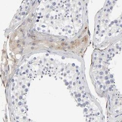 LRP-1 Antibody, Novus Biologicals:Antibodies:Primary Antibodies