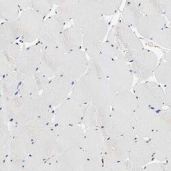 LRP-1 Antibody, Novus Biologicals:Antibodies:Primary Antibodies