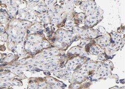 LRP-1 Antibody, Novus Biologicals:Antibodies:Primary Antibodies