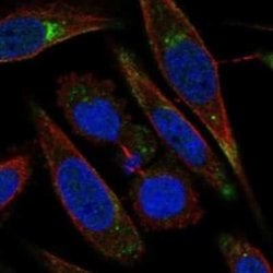 LRP-11 Rabbit anti-Human, Polyclonal, Novus Biologicals 25 &mu;g; Unconjugated:Antibodies,