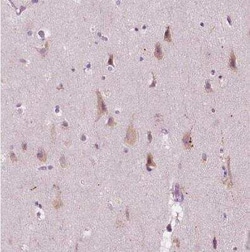 LRP-1B Antibody, Novus Biologicals 25 &mu;L, Unconjugated:Antibodies, Polyclonal