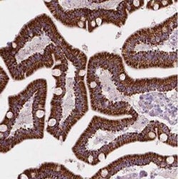 LRP-1B Antibody, Novus Biologicals 25 &mu;L, Unconjugated:Antibodies, Polyclonal