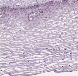 LRP-1B Antibody, Novus Biologicals 25 &mu;L, Unconjugated:Antibodies, Polyclonal