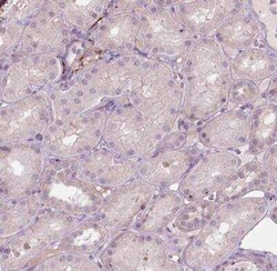 LRP-1B Antibody, Novus Biologicals 25 &mu;L, Unconjugated:Antibodies, Polyclonal