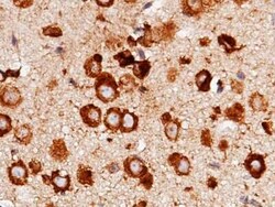 LRPAP Rabbit anti-Mouse, Clone: 11, Novus Biologicals 100 &mu;g; Unconjugated:Antibodies,