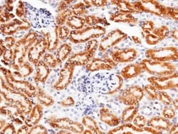 LRPAP Rabbit anti-Mouse, Clone: 11, Novus Biologicals 100 &mu;g; Unconjugated:Antibodies,
