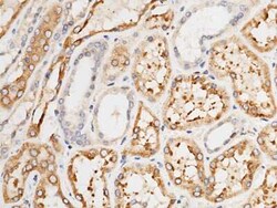 LRPAP Antibody, Novus Biologicals 50 &mu;g; Unconjugated:Antibodies, Polyclonal