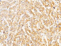 LRPAP Antibody, Novus Biologicals 50 &mu;g; Unconjugated:Antibodies, Polyclonal