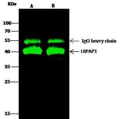 LRPAP Antibody, Novus Biologicals 50 &mu;g; Unconjugated:Antibodies, Polyclonal