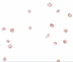 LRRC19 Antibody - BSA Free, Novus Biologicals 0.1 mg | Buy Online | Novus Biologicals | Fisher Scientific