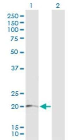 LRRC20 Antibody, Novus Biologicals 0.05 mg | Buy Online | Novus Biologicals | Fisher Scientific