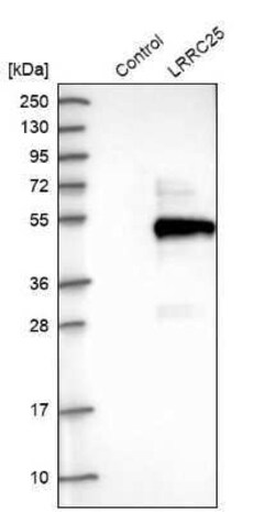 LRRC25 Antibody, Novus Biologicals 25 &mu;L | Buy Online | Novus Biologicals | Fisher Scientific