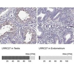 LRRC27 Antibody, Novus Biologicals 100 &mu;g; Unconjugated:Antibodies,