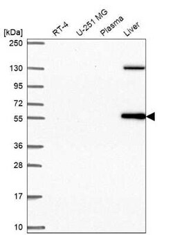 LRRC27 Antibody, Novus Biologicals 100 &mu;g; Unconjugated:Antibodies,