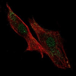 LRRC32/GARP Antibody, Novus Biologicals 25ul; Unconjugated:Antibodies,