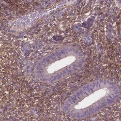 LRRC3C Antibody, Novus Biologicals 25 &mu;L, Unconjugated:Antibodies, Polyclonal
