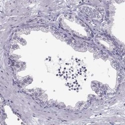LRRC50 Antibody, Novus Biologicals 25ul; Unconjugated:Antibodies, Polyclonal