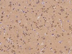 LRRC56 Antibody, Novus Biologicals 100 &mu;g | Buy Online | Novus Biologicals | Fisher Scientific