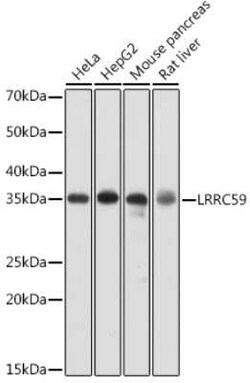 LRRC59 Rabbit anti-Human, Mouse, Rat, Polyclonal, Novus Biologicals 20 &mu;g | Buy Online | Novus Biologicals | Fisher Scientific