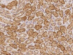 LRRC74A Antibody, Novus Biologicals:Antibodies:Primary Antibodies