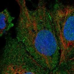 LRRC9 Rabbit anti-Human, Polyclonal, Novus Biologicals 25 &mu;g | Buy Online | Novus Biologicals | Fisher Scientific