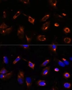 LRRFIP2 Rabbit anti-Human, Mouse, Rat, Polyclonal, Novus Biologicals 100 &mu;g | Buy Online | Novus Biologicals | Fisher Scientific