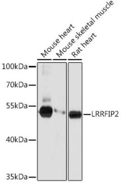 LRRFIP2 Rabbit anti-Human, Mouse, Rat, Polyclonal, Novus Biologicals 100 &mu;g | Buy Online | Novus Biologicals | Fisher Scientific