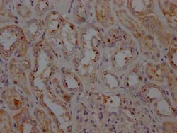 LRRK2 Antibody (4E9), Novus Biologicals 100 &mu;g | Buy Online | Novus Biologicals | Fisher Scientific