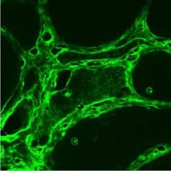 LRRK2 Antibody Pack, Novus Biologicals™