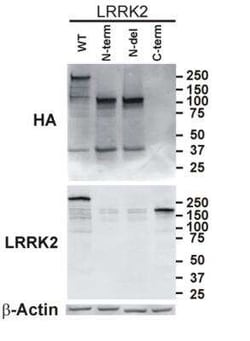 LRRK2 Antibody Pack, Novus Biologicals 1 Pack; Unconjugated:Antibodies