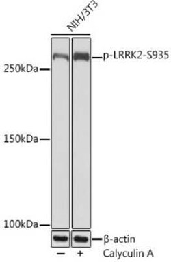LRRK2 Rabbit anti-Human, Mouse, Rat, Clone: 4J10Z7, Novus Biologicals 100 &mu;g | Buy Online | Bio-Techne | Fisher Scientific