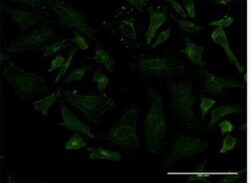LRRN1/NLRR-1 Antibody (3F1), Novus Biologicals 100 &mu;g | Buy Online | Novus Biologicals | Fisher Scientific