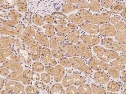 LRTM2 Antibody, Novus Biologicals 50 &mu;g; Unconjugated:Antibodies, Polyclonal