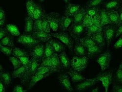 LRWD1 Antibody, Novus Biologicals 100 &mu;g, Unconjugated:Antibodies, Polyclonal