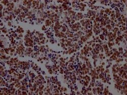 LSD1 Antibody (1G7), Novus Biologicals 100 &mu;g; Unconjugated:Antibodies,