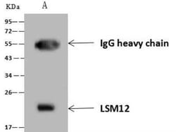 LSM12 Antibody, Novus Biologicals:Antibodies:Primary Antibodies