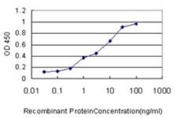 LSM3 Antibody (4C8-2D10), Novus Biologicals 0.1 mg | Buy Online | Novus Biologicals | Fisher Scientific