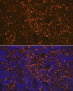 LSP1 Rabbit anti-Human, Mouse, Rat, Clone: 4U10N5, Novus Biologicals 100 &mu;g | Buy Online | Novus Biologicals | Fisher Scientific