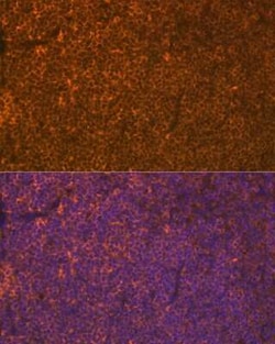 LSP1 Rabbit anti-Human, Mouse, Rat, Clone: 4U10N5, Novus Biologicals 100 &mu;g | Buy Online | Novus Biologicals | Fisher Scientific