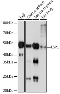 LSP1 Rabbit anti-Human, Mouse, Rat, Clone: 4U10N5, Novus Biologicals 100 &mu;g | Buy Online | Novus Biologicals | Fisher Scientific
