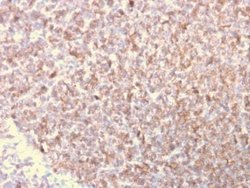 LSP1 Antibody (LSP1/3025) - Azide and BSA Free, Novus Biologicals 100 ug;