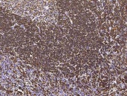 LSP1 Antibody, Novus Biologicals:Antibodies:Primary Antibodies