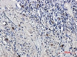 LTK Antibody (S02-8A4), Novus Biologicals:Antibodies:Primary Antibodies