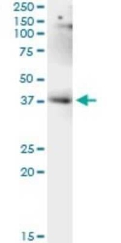 LUC7L Antibody (2D10), Novus Biologicals 0.1 mg | Buy Online | Novus Biologicals | Fisher Scientific