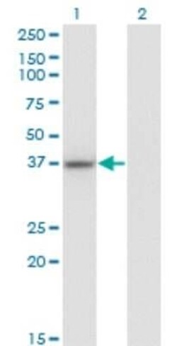 LUC7L Antibody (2D10), Novus Biologicals 0.1 mg | Buy Online | Novus Biologicals | Fisher Scientific